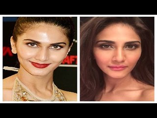 CHECK OUT | Vaani Kapoor Undergoes Lip Surgery To Boost Career?