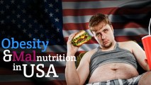 Obesity and Malnutrition in USA