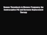 PDF Download Venous Thrombosis in Women: Pregnancy the Contraceptive Pill and Hormone Replacement