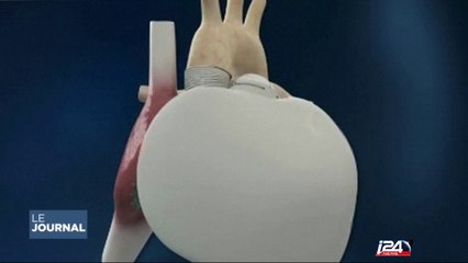 Le 4e patient greffé d'un coeur artificiel est mort