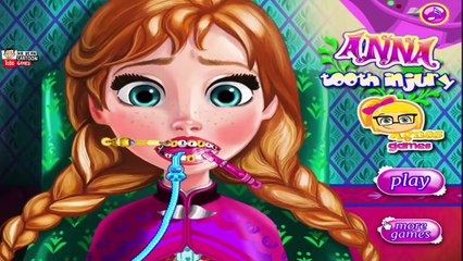 ᴴᴰ ღ Anna Tooth Injury ღ - Princess Anna Baby Game - Baby Games (ST)