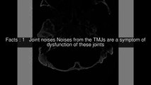 Joint noises of Temporomandibular joint dysfunction Top 11 Facts