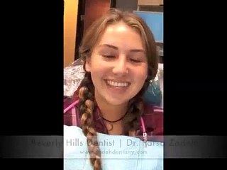 Beverly Hills Dentist¦ Dr. Parsa Zadeh ¦ Braces
