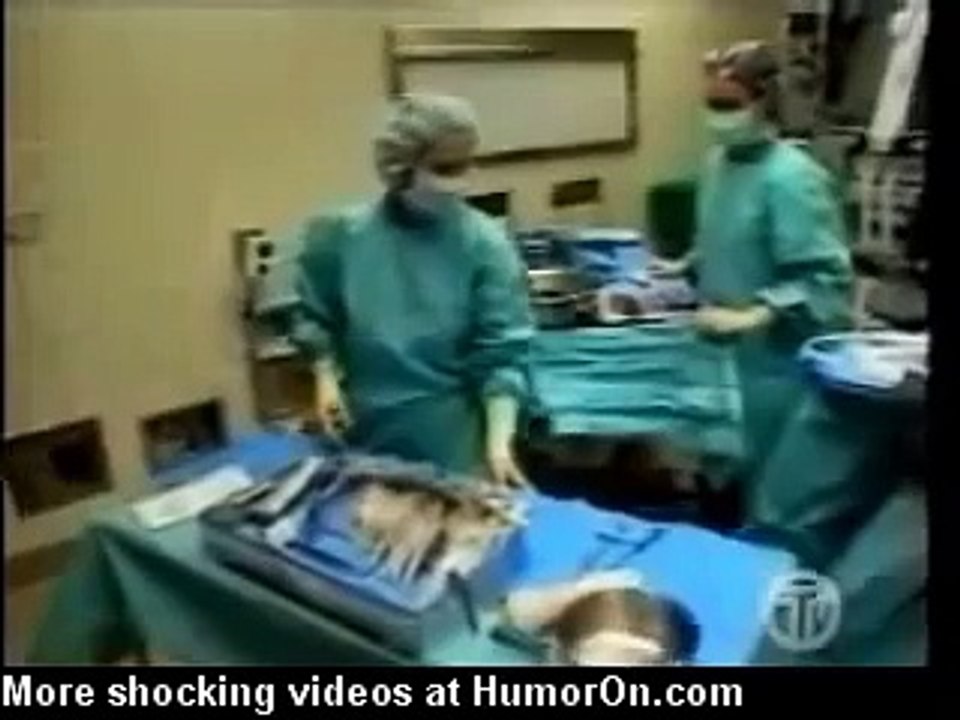 303 lb Tumor Removed from Woman's Stomach | Guinness World Record
