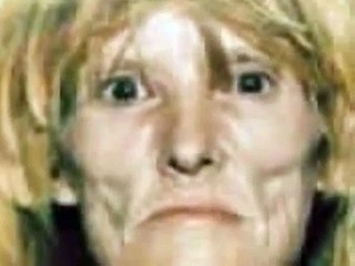 Face of addiction The effects of crystal meth