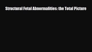 PDF Download Structural Fetal Abnormalities: the Total Picture Read Full Ebook