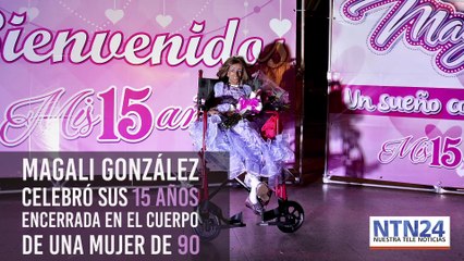 Conozca a Magali, la niña colombiana con progeria que cumple 15 años con aspecto de 90