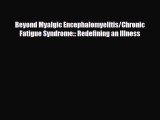 [PDF Download] Beyond Myalgic Encephalomyelitis/Chronic Fatigue Syndrome:: Redefining an Illness