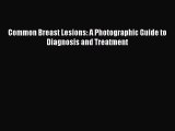 [PDF Download] Common Breast Lesions: A Photographic Guide to Diagnosis and Treatment [Read]