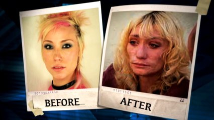 A Sobering Look at What Meth Can Do to Your Appearance