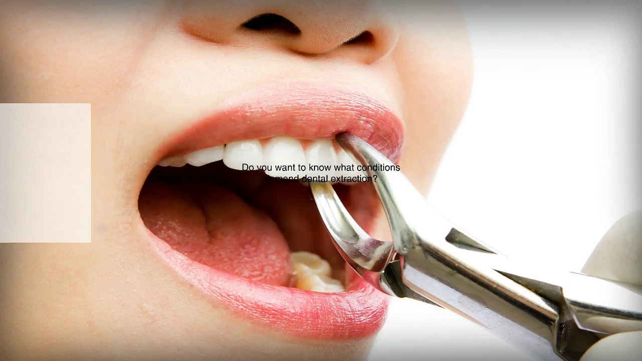 What Conditions Demand Dental Extraction?