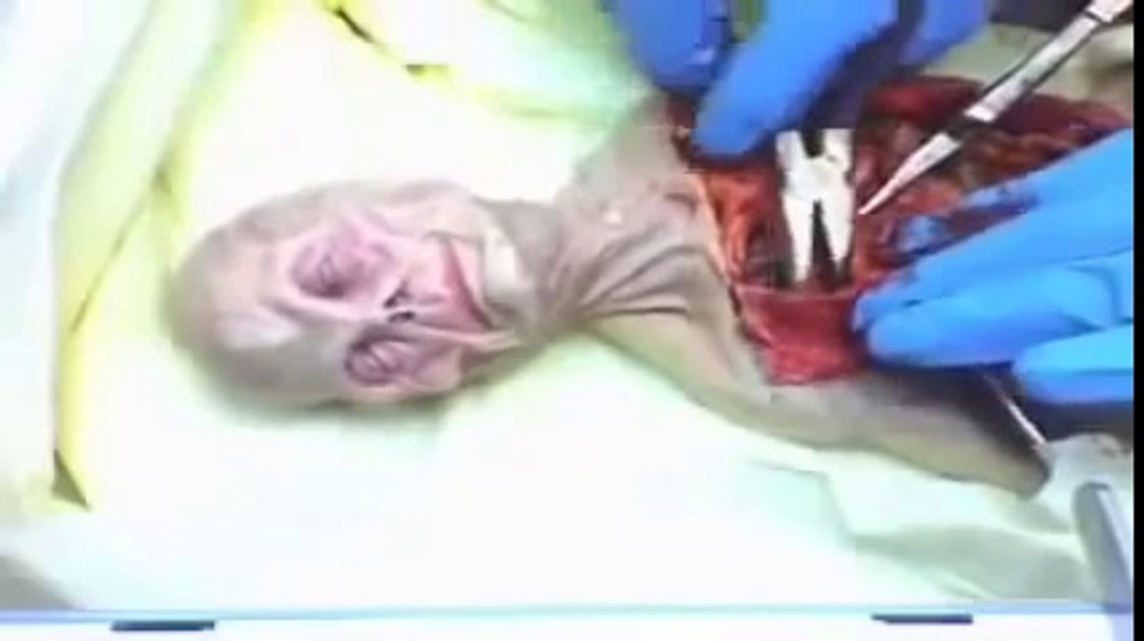Top Secret KGB Files - Alien Autopsy in Russia 1969