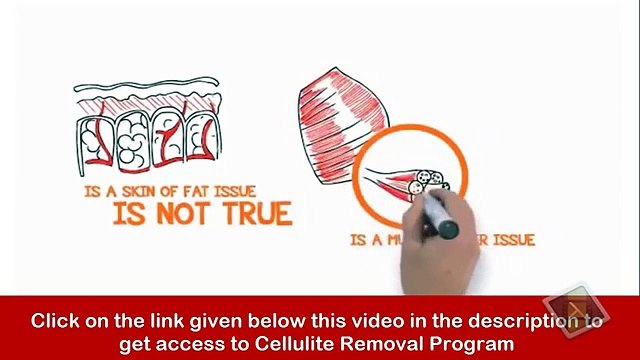 was hilft bei cellulite Free Cellulite Removal Presentation