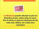 Remedios Para La Rosacea En La Nariz - Que Es Lo Mejor Para La Rosacea