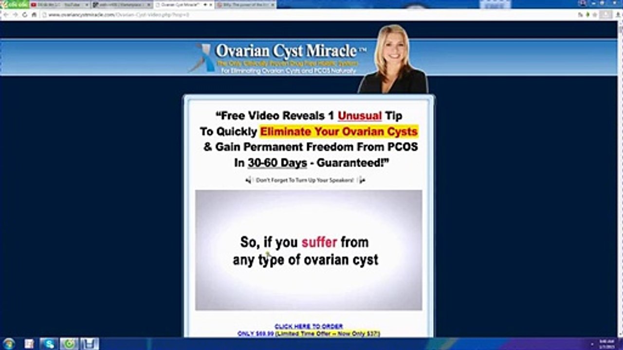 Ovarian Cyst Miracle™ - Cure Ovarian Cysts and PCOS Naturally