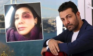 Sevgilisini Darp Eden Saruhan Hünel'in 17 Yıl Hapsi İsteniyor
