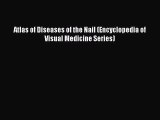 [PDF Download] Atlas of Diseases of the Nail (Encyclopedia of Visual Medicine Series) [Download]