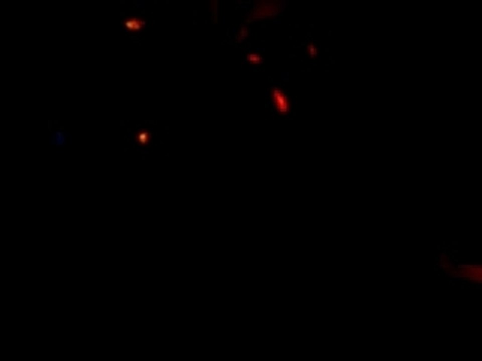 RUPTURES CHAUD DEVANT !!!! -MANS