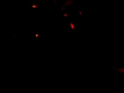 RUPTURES CHAUD DEVANT !!!! -MANS