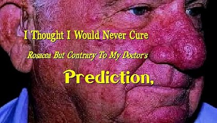 How Do You Treat Rosacea