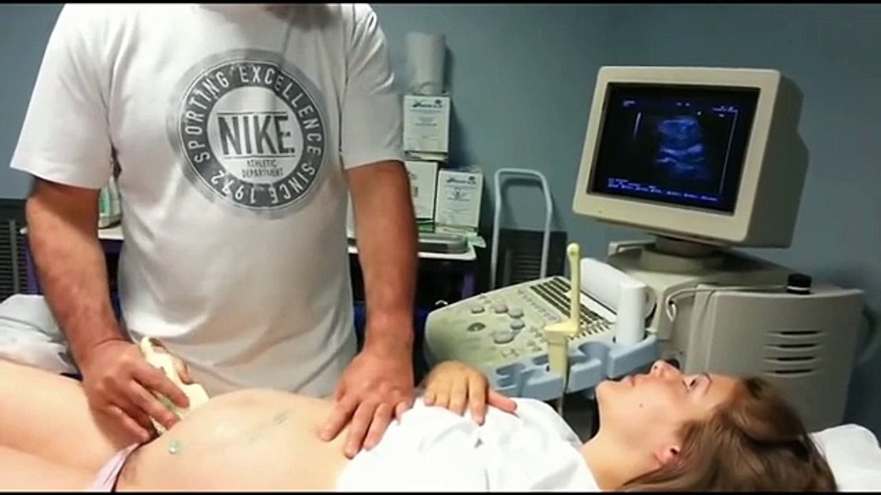 How to turn a breech baby at 37 weeks