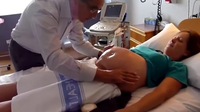 Watch the incredible moment a doctor turns a breech baby around in a pregnant woman's stomach