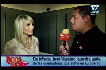 Jasú Montero muestra parte de las quemadura que sufrió en su cuerpo