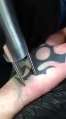 Lazerle dövme silmek