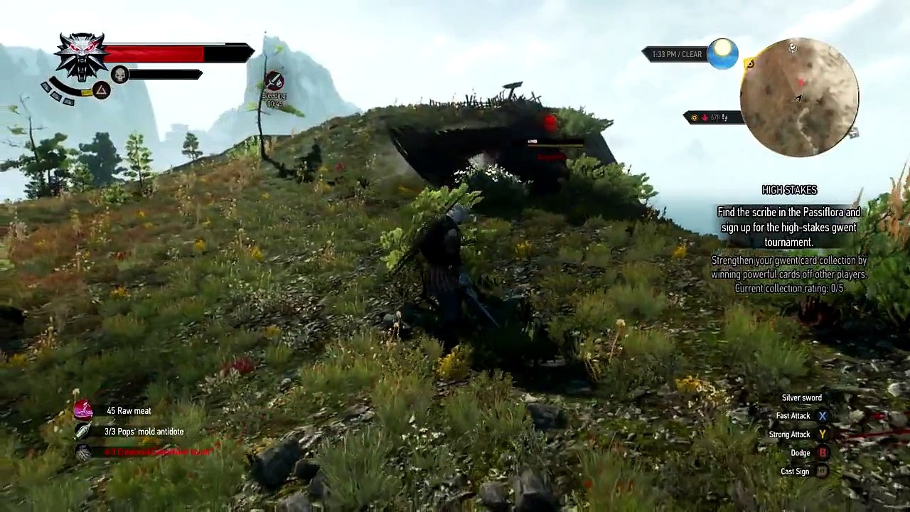The Witcher 3 Glitches God Mode & Unlimited Damage Glitch - video  Dailymotion