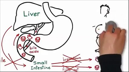 Fat Loss Factor - Detox Your Liver To Lose Fat