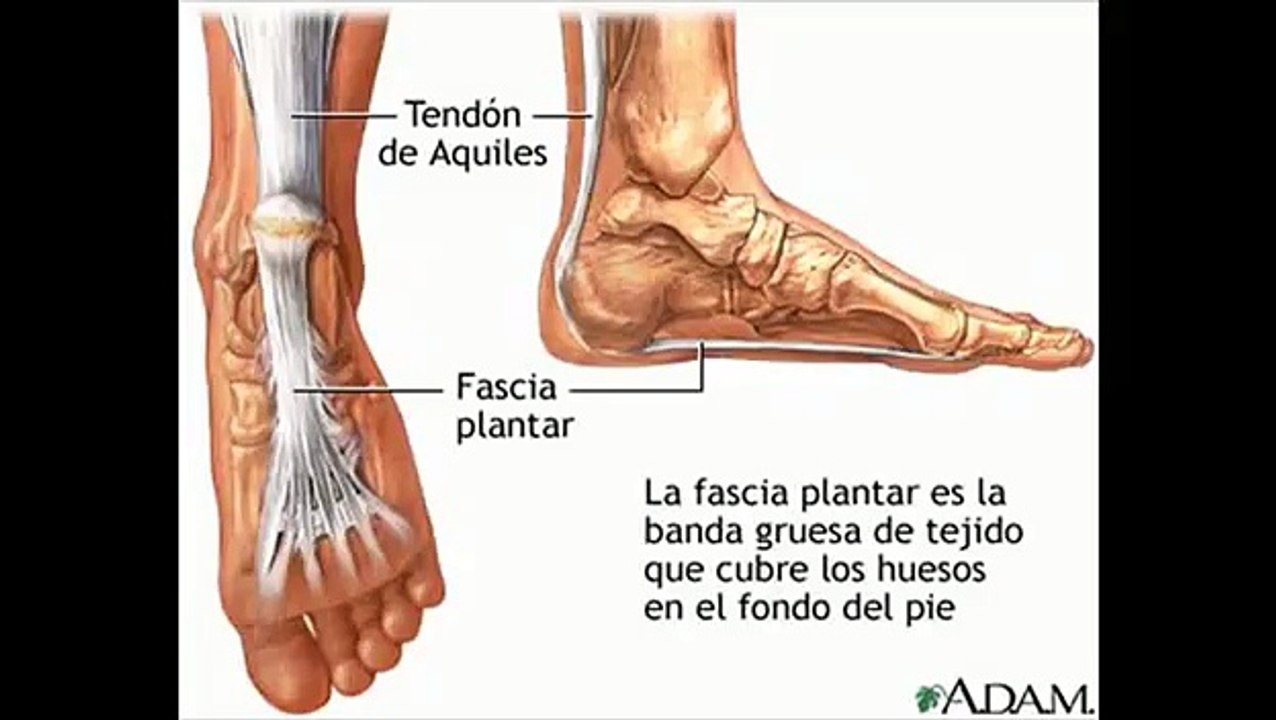 Fast Plantar Fasciitis Cure™!