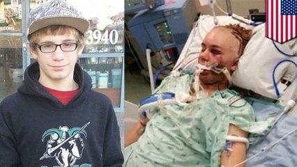 ‘Duct tape challenge’ leaves teen blind in one eye but glad to be alive