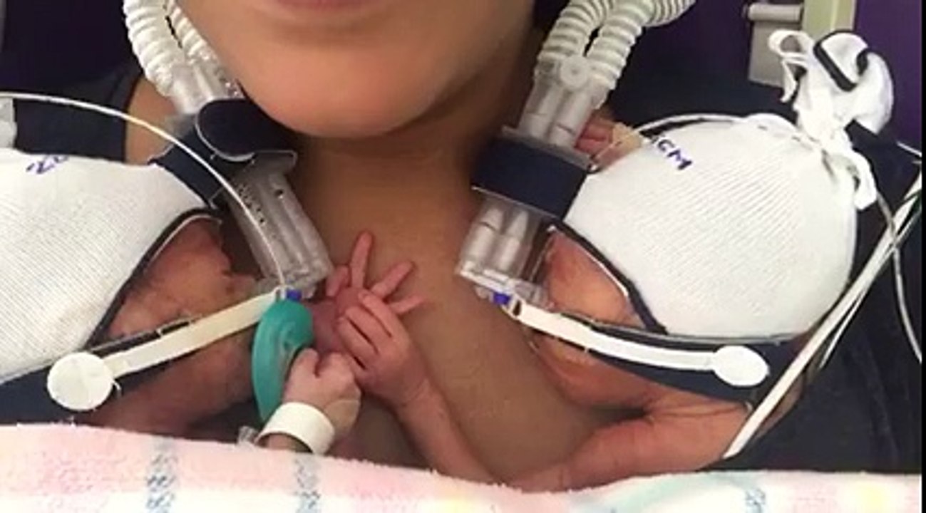 Twins holding hands