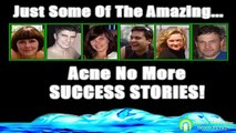 Acne No More Review and Success Reports From Real Consumers