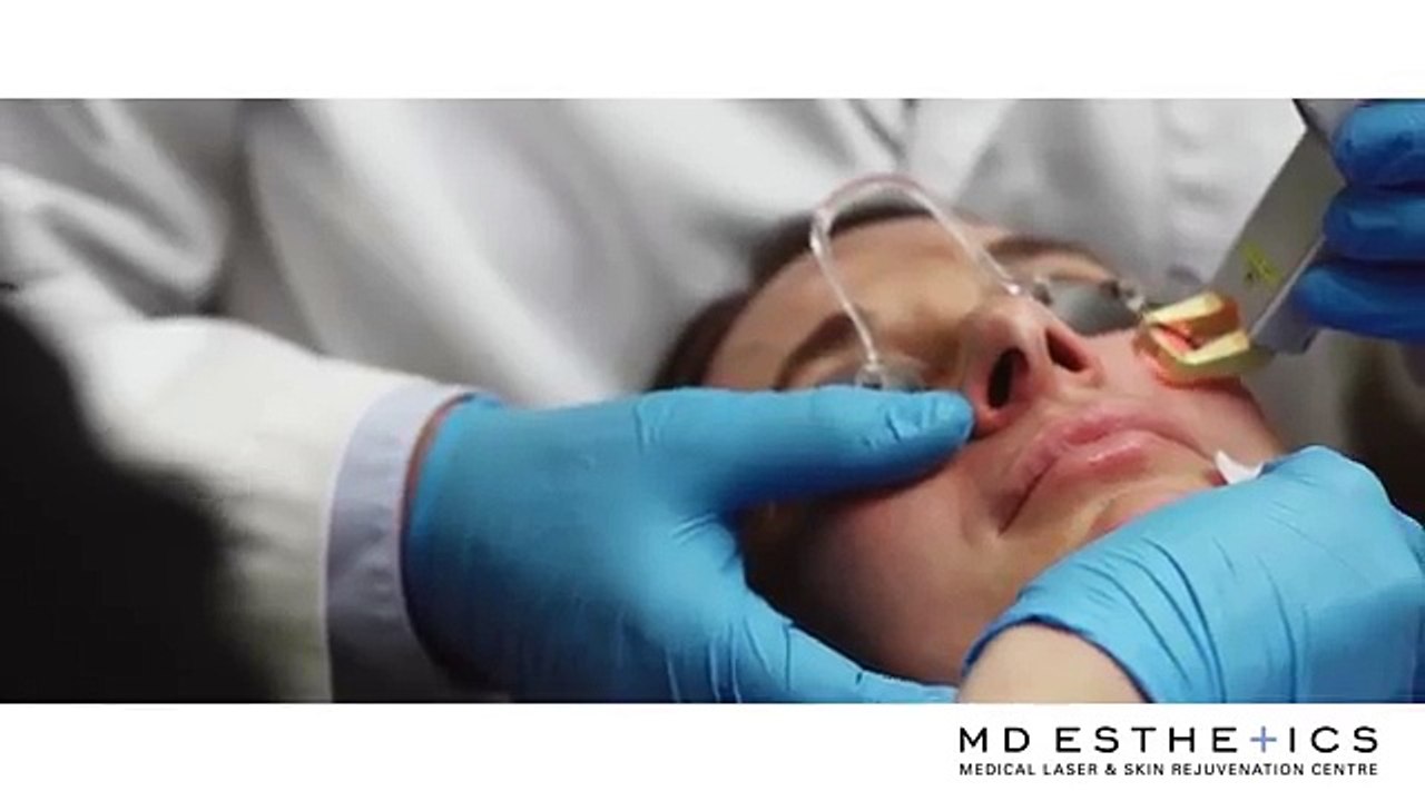 MD Esthetics   Rosacea