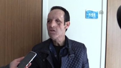 Yüz Nakli Yapılan Recep Sert Baba Oldu (Röportaj)
