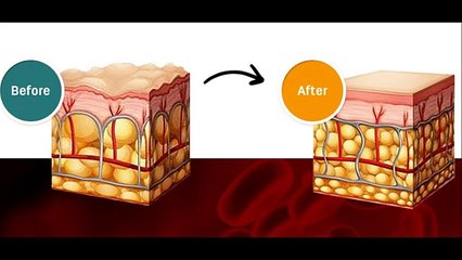 Cellulite Factor Solution Guide BY Dr  Charles