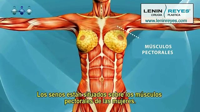 Cirugía aumento de busto