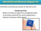 Remedios Caseros Para La Rosacea En La Cara - Solución