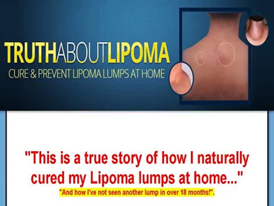 Truth About Lipoma