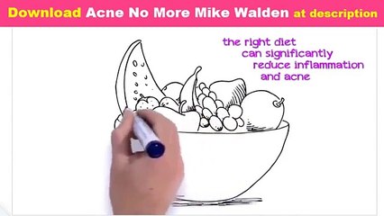 ►►Acne No More Free Ebook Download   Mike Walden Review!!