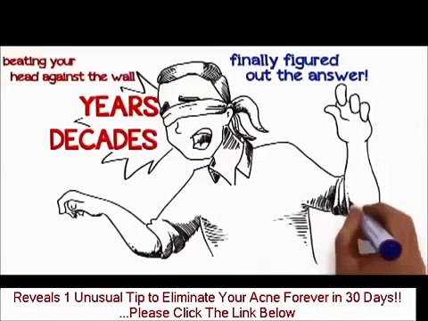 Best Acne treatment Product Reviews. Acne no more
