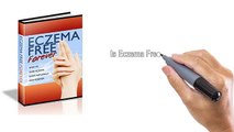 How To Eczema Treatment ↪↪ Eczema Free Forever For Eczema Cure