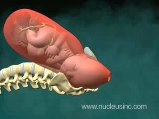 Accouchement 3d