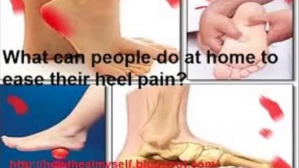 Fast Plantar Fasciitis Cure  2015