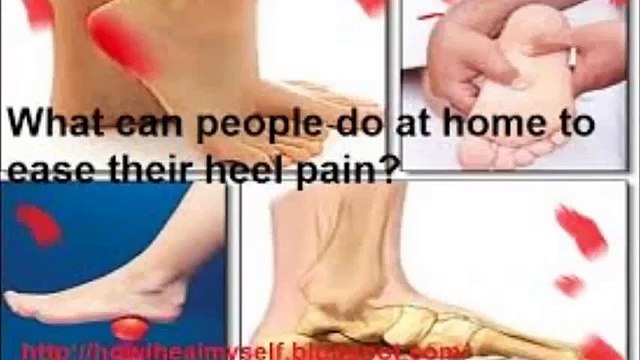 Fast Plantar Fasciitis Cure 2015