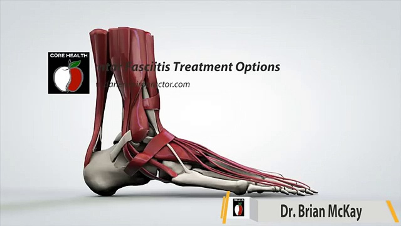 Plantar Fasciitis Pain when Exercising Stamford 203 656 3636 Darien Chiropractor Norwalk New Canaan