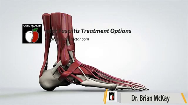 Plantar Fasciitis Pain when Exercising Stamford 203 656 3636 Darien Chiropractor Norwalk New Canaan