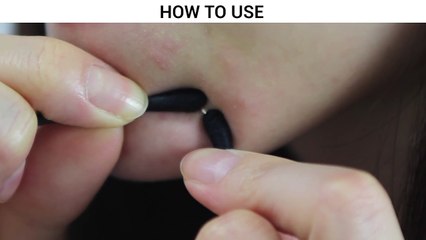 [COSRX] Acne Pimple Master Patch