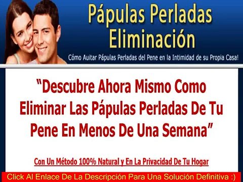 Papulas Perladas Eliminacion